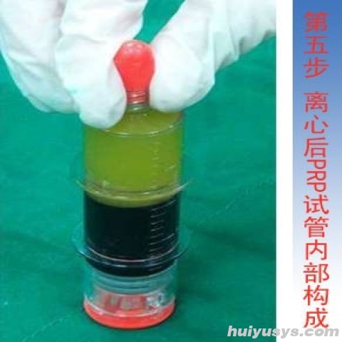 卢湘仪仪器 TD4P 细胞洗涤离心机